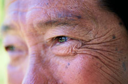 California Anti-aging Skin Treatment