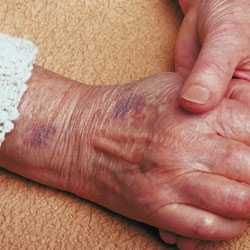 Red Bluff Anti-aging Skin Treatment