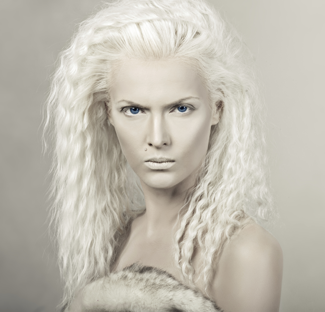 Albino Woman