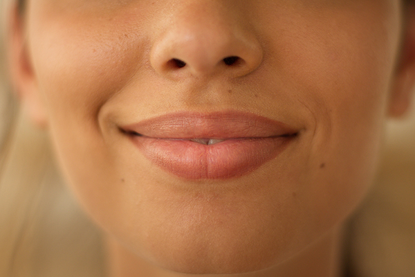 Juvéderm Treatments In Red Bluff At Vita Dermatology